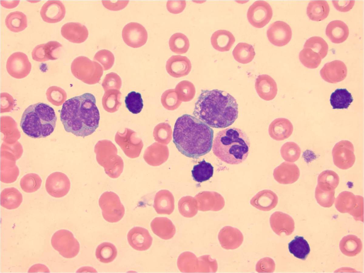 Image 4 Peripheral Blood